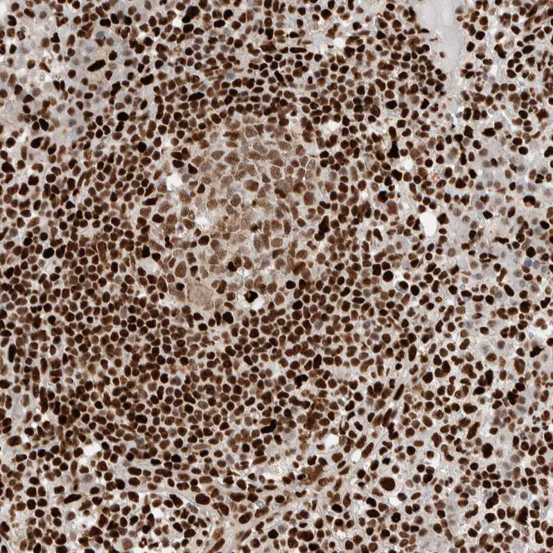 Anti-C17ORF49 Antibody