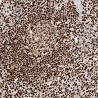 Anti-C17ORF49 Antibody