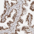 Immunohistochemical staining of human fallopian tube shows moderate to strong nuclear positivity in glandular cells.