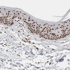 Immunohistochemical staining of human skin shows moderate to strong nuclear positivity in squamous epithelial cells.