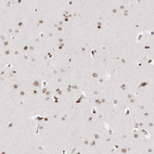 Anti-C17ORF49 Antibody