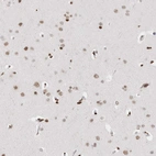 Immunohistochemical staining of human cerebral cortex shows weak to moderate nuclear positivity in neurons and glial cells.