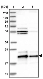 Lane 1: Marker [kDa] 230, 130, 95, 72, 56, 36, 28, 17, 11_br/_Lane 2: Human cell line RT-4_br/_Lane 3: Human cell line U-251MG sp