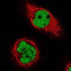 Immunofluorescent staining of human cell line A-431 shows localization to nucleoplasm.
