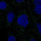 Anti-RSAD1 Antibody