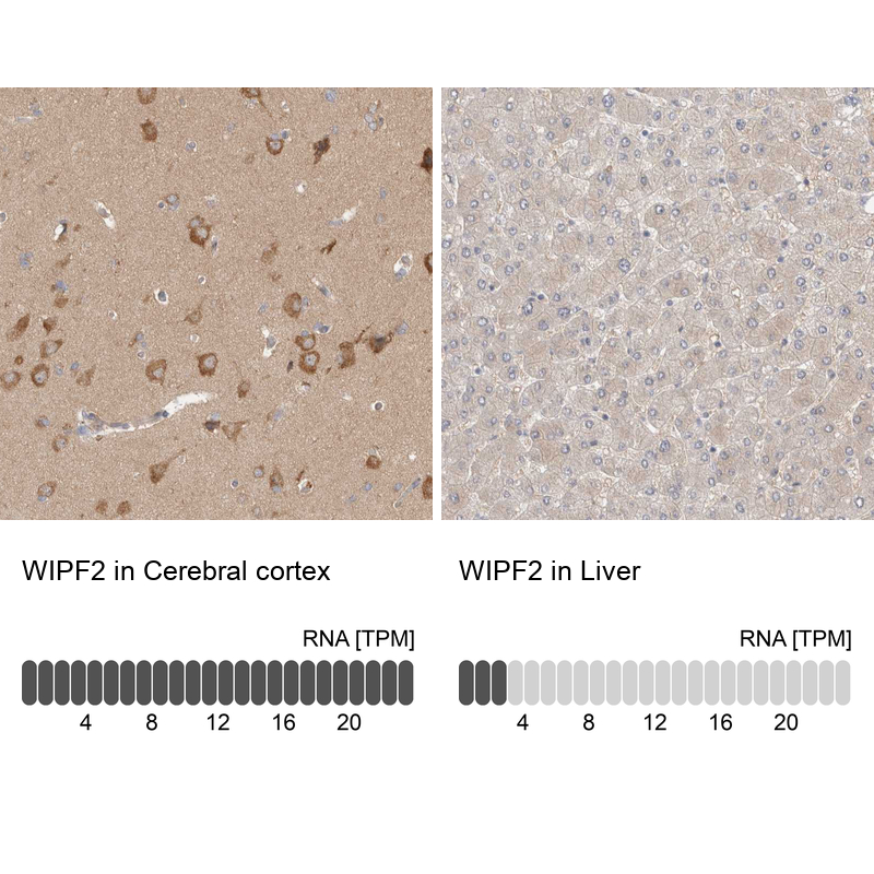 Anti-WIPF2 Antibody