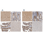 Immunohistochemical staining of human cerebral cortex, colon, fallopian tube and liver using Anti-WIPF2 antibody HPA024467 (A) shows similar protein distribution across tissues to independent antibody HPA024000 (B).