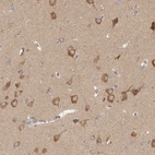 Immunohistochemical staining of human cerebral cortex shows strong cytoplasmic positivity in neurons.