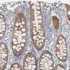 Immunohistochemical staining of human colon shows moderate cytoplasmic positivity in glandular cells.