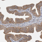 Immunohistochemical staining of human Fallopian tube shows moderate cytoplasmic positivity in glandular cells.