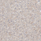 Immunohistochemical staining of human liver shows very weak positivity in hepatocytes as expected.