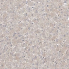 Immunohistochemical staining of human liver shows very weak positivity in hepatocytes as expected.
