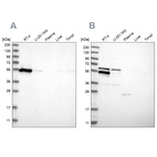 Western blot analysis using Anti-WIPF2 antibody HPA024467 (A) shows similar pattern to independent antibody HPA024000 (B).