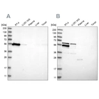 Western blot analysis using Anti-WIPF2 antibody HPA024467 (A) shows similar pattern to independent antibody HPA024000 (B).