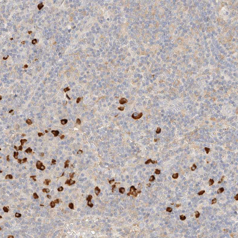 Anti-FHOD1 Antibody