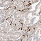 Immunohistochemical staining of human gastrointestinal shows strong cytoplasmic positivity in lymphoid cells.