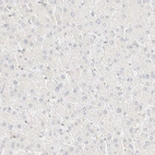 Immunohistochemical staining of human liver shows no cytoplasmic positivity in hepatocytes as expected.