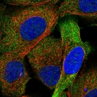 Immunofluorescent staining of human cell line A-431 shows localization to cytosol.
