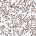 Immunohistochemical staining of human lung shows weak to moderate cytoplasmic positivity in pneumocytes.