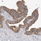 Anti-CAPN2 Antibody