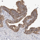 Immunohistochemical staining of human fallopian tube shows weak to moderate cytoplasmic positivity in glandular cells.