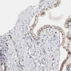 Immunohistochemical staining of human cervix, uterine shows weak to moderate cytoplasmic positivity in glandular cells.