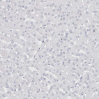 Immunohistochemical staining of human liver shows no positivity in hepatocytes as expected.