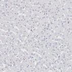 Immunohistochemical staining of human liver shows no positivity in hepatocytes as expected.