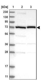 Lane 1: Marker [kDa] 230, 130, 95, 72, 56, 36, 28, 17, 11_br/_Lane 2: Human cell line RT-4_br/_Lane 3: Human cell line U-251MG sp