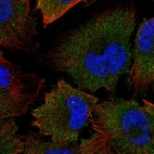 Immunofluorescent staining of human cell line U-251 MG shows localization to cytosol.