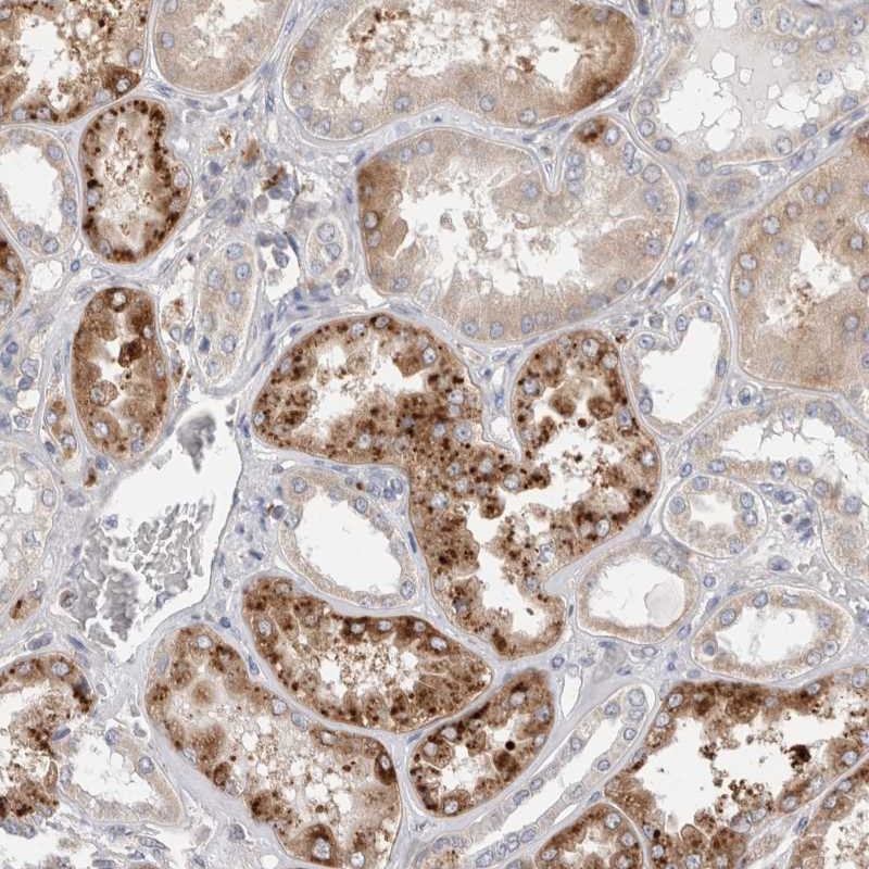 Anti-TBC1D16 Antibody