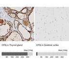 Anti-CPQ Antibody