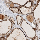 Immunohistochemical staining of human thyroid gland shows high expression.