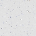 Immunohistochemical staining of human cerebral cortex shows low expression as expected.