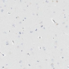 Immunohistochemical staining of human cerebral cortex shows low expression as expected.