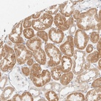 Anti-UNC13B Antibody