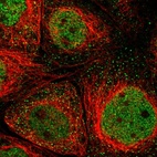 Immunofluorescent staining of human cell line A-431 shows localization to nucleoplasm & vesicles.