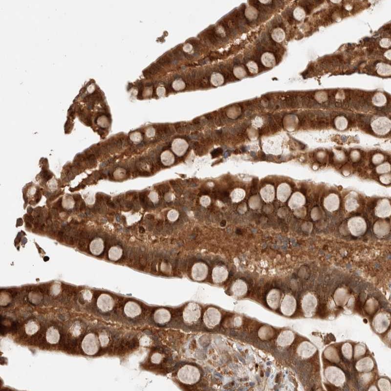 Anti-OTUD6B Antibody