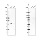 Western blot analysis using Anti-OTUD6B antibody HPA024503 (A) shows similar pattern to independent antibody HPA024046 (B).