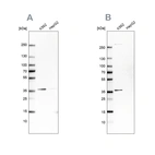 Western blot analysis using Anti-OTUD6B antibody HPA024503 (A) shows similar pattern to independent antibody HPA024046 (B).