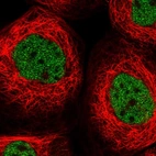 Immunofluorescent staining of human cell line A-431 shows localization to nucleoplasm.