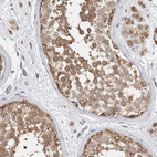 Immunohistochemical staining of human testis shows moderate cytoplasmic positivity in cells in seminiferous ducts.