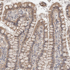 Immunohistochemical staining of human small intestine shows moderate cytoplasmic positivity in glandular cells.