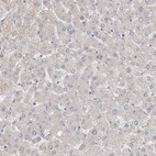 Immunohistochemical staining of human liver shows no positivity in hepatocytes as expected.