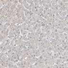 Immunohistochemical staining of human liver shows no positivity in hepatocytes as expected.