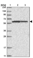 Lane 1: Marker [kDa] 230, 130, 95, 72, 56, 36, 28, 17, 11_br/_Lane 2: Human cell line RT-4_br/_Lane 3: Human cell line U-251MG sp