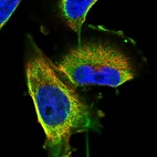 Immunofluorescent staining of human cell line U-251 MG shows localization to cytosol & intermediate filaments.