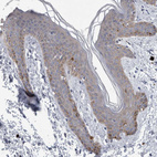 Anti-FAM83H Antibody