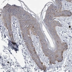Immunohistochemical staining of human skin shows strong cytoplasmic positivity in melanocytes.