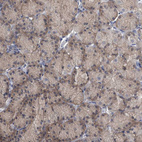 Immunohistochemical staining of human stomach shows weak cytoplasmic positivity in glandular cells.